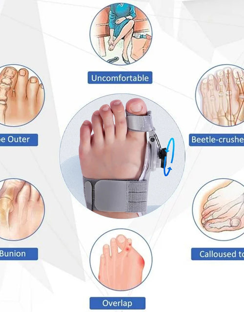 Load image into Gallery viewer, Bunion Corrector Unisex Foot Hallux Valgus Braces Rotatable Toe Separator Straightener Adjustable Pedicure Finger Toe Corrector
