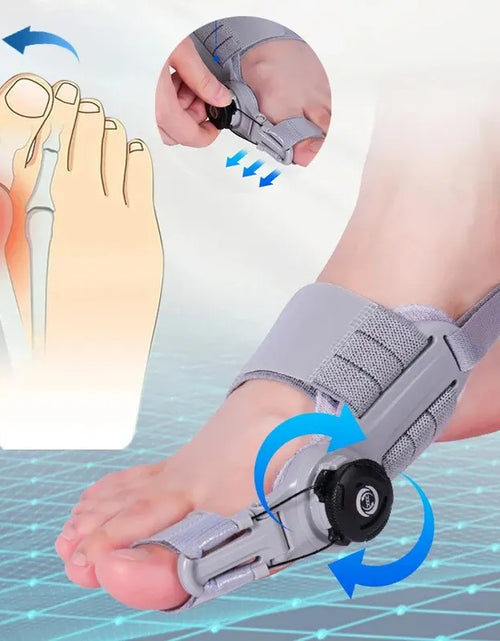 Load image into Gallery viewer, Bunion Corrector Unisex Foot Hallux Valgus Braces Rotatable Toe Separator Straightener Adjustable Pedicure Finger Toe Corrector
