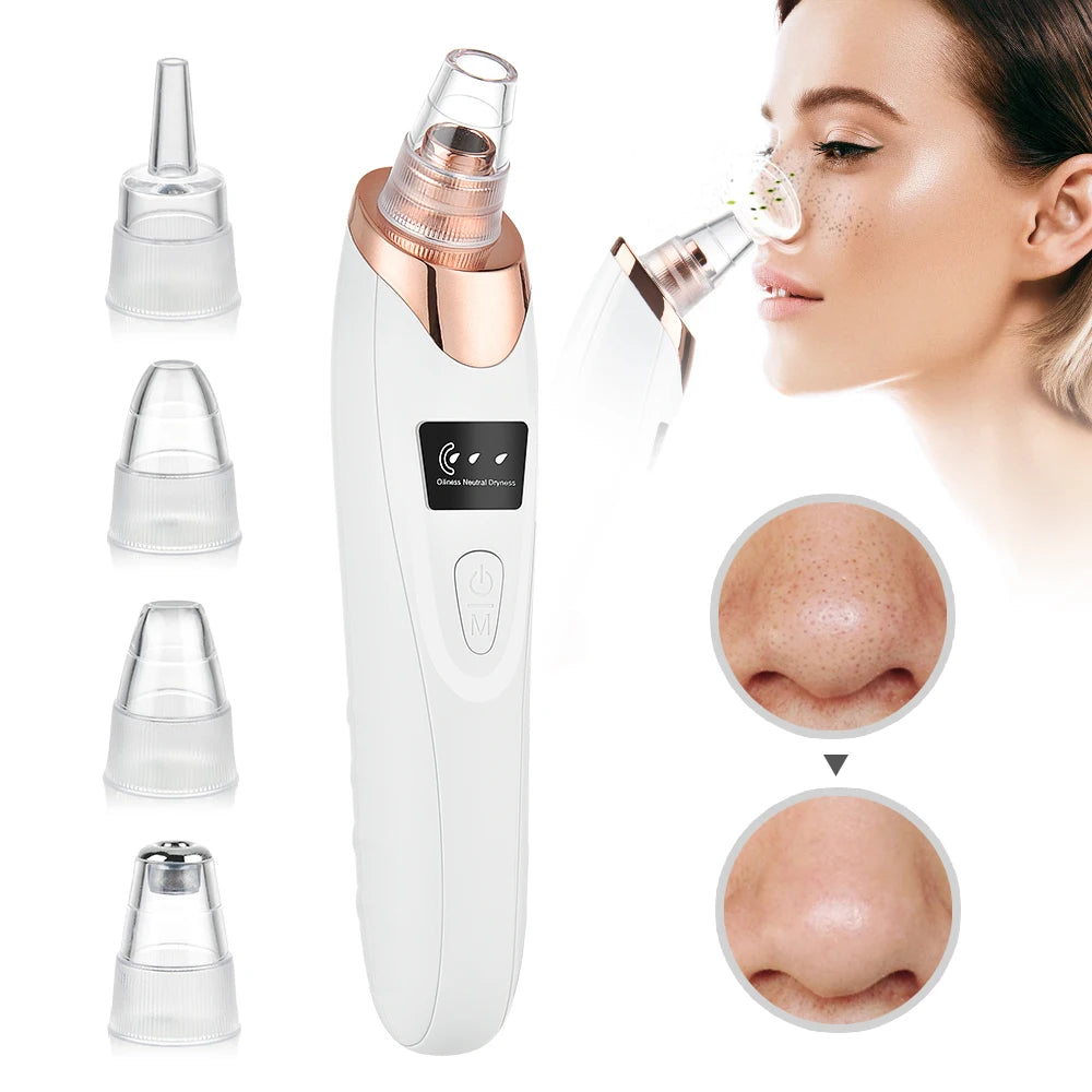 Vacuum Suction Blackhead Remover Acne Needle Set Facial Pore Cleaner Black Spots Acne Pimple Black Head Extractor Skin Care Tool